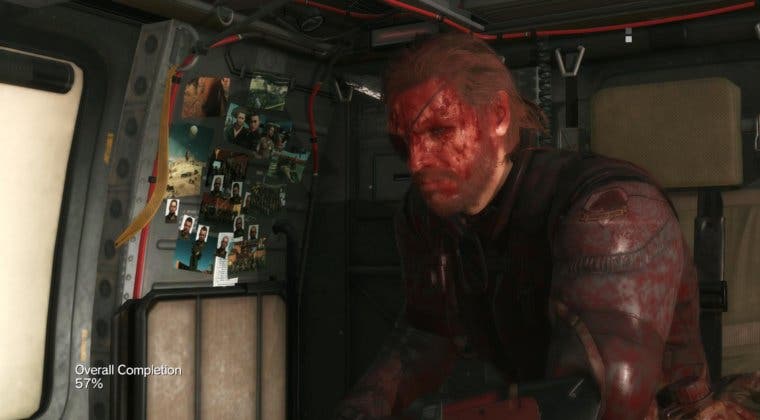 Imagen de Descubre el sistema de karma de Metal Gear Solid V: The Phantom Pain