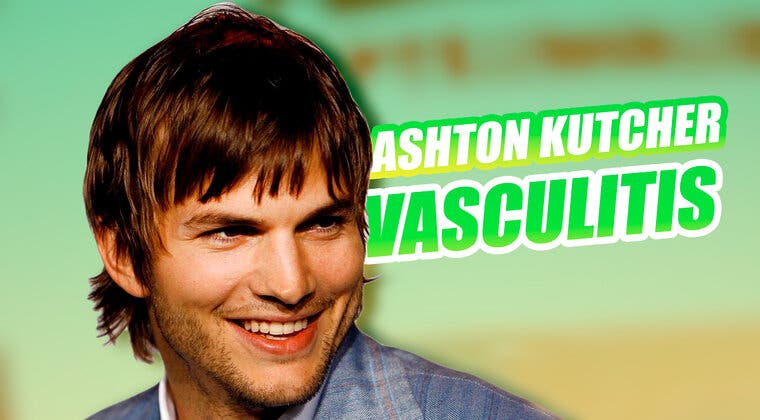 Imagen de Vasculitis: La extraña enfermedad que sufre Ashton Kutcher y qué implica para su día a día