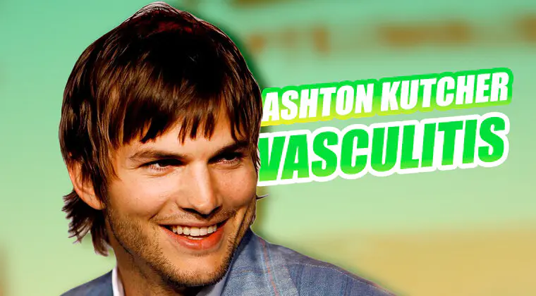 Imagen de Vasculitis: La extraña enfermedad que sufre Ashton Kutcher y qué implica para su día a día