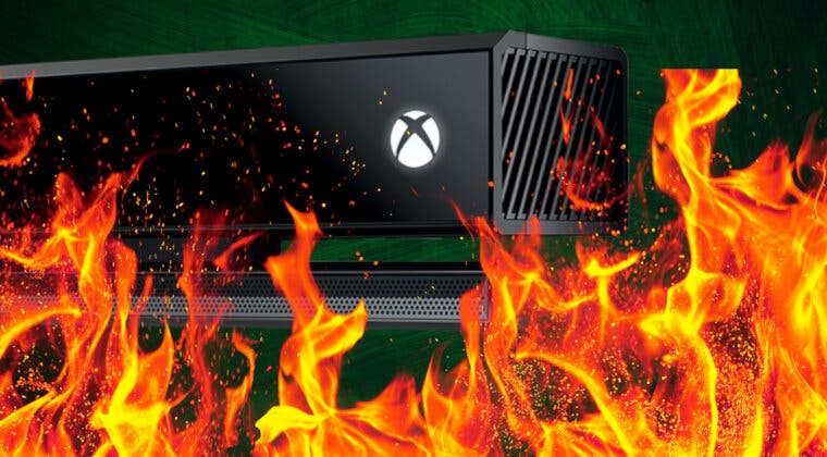 Imagen de Fue de los productos más odiados de Xbox, pero pronto se revalorizará muchísimo