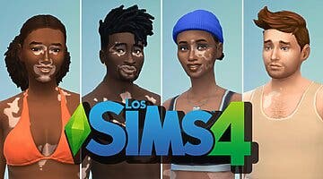 Imagen de Los Sims 4 agregan piel de vitiligo en su última actualización gratuita