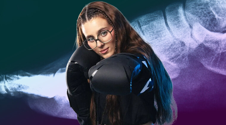 Imagen de Roro muestra la fractura que se hizo en el pie durante su combate en La Velada del Año 5